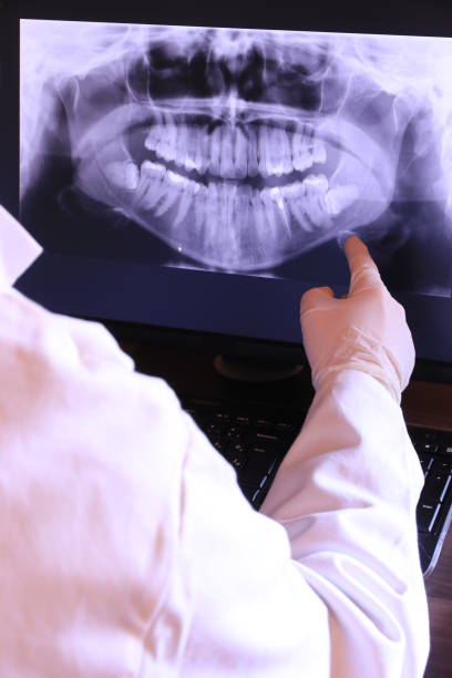 Best Dental Abscess Treatment in Trappe, PA