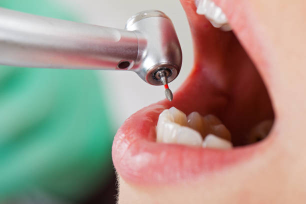 Best Emergency Root Canal Therapy in Trappe, PA